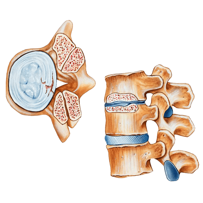 spine inforgraphic