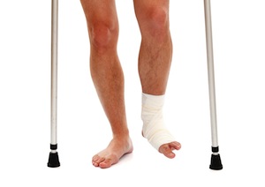 Injured Leg