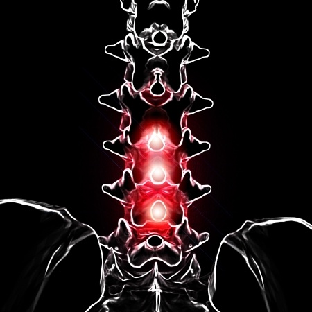 spinal pain black image