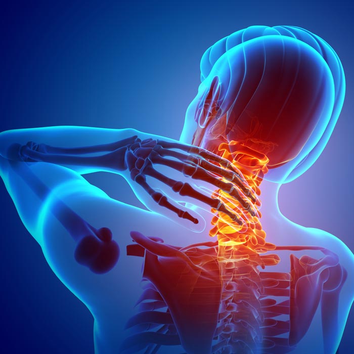 neck pain illustration