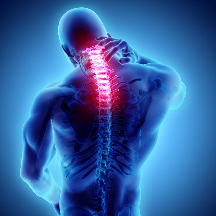 neck pain illustration