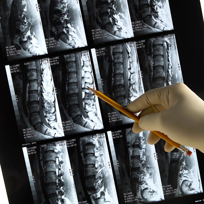 digital spine x-rays
